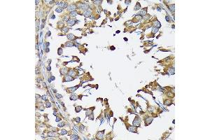 Immunohistochemistry of paraffin-embedded rat testis using LysRS/KARS Rabbit mAb (ABIN7268350) at dilution of 1:100 (40x lens). (KARS antibody)