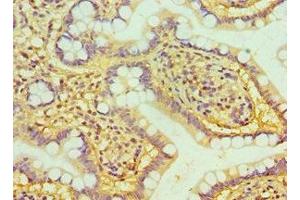 Immunohistochemistry of paraffin-embedded human small intestine tissue using ABIN7162382 at dilution of 1:100 (HIV-1 Tat Interactive Protein 2, 30kDa (HTATIP2) (AA 1-230) antibody)