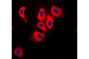 Immunofluorescent analysis of JIP2 staining in Raw264. (IB2 antibody  (C-Term))
