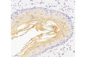 Immunohistochemistry (Paraffin-embedded Sections) (IHC (p)) image for anti-Desmoplakin (DSP) antibody (ABIN7073719)