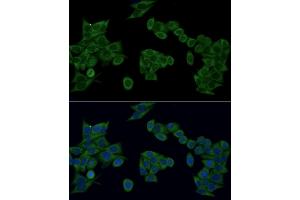 Immunofluorescence analysis of HeLa cells using IRF3 antibody (ABIN6128099, ABIN6142528, ABIN6142531 and ABIN7101371) at dilution of 1:100 (40x lens). (IRF3 antibody  (AA 1-260))