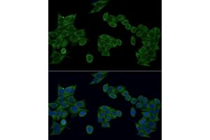 Immunofluorescence analysis of HeLa cells using IRF3 antibody (ABIN6128099, ABIN6142528, ABIN6142531 and ABIN7101371) at dilution of 1:100 (40x lens). (IRF3 antibody  (AA 1-260))