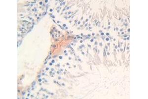Figure. (LCN9 antibody  (AA 33-163))