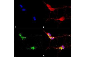 Immunocytochemistry/Immunofluorescence analysis using Mouse Anti-TrpV3 Monoclonal Antibody, Clone N15/4 (ABIN2485352). (TRPV3 antibody  (AA 774-791) (Atto 488))