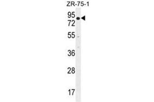 BRTC1 Antibody (N-term) western blot analysis in ZR-75-1 cell line lysates (35µg/lane). (BTRC antibody  (N-Term))