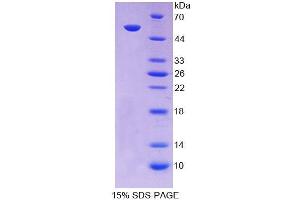 SDS-PAGE (SDS) image for Sodium Channel, Nonvoltage-Gated 1 alpha (SCNN1A) (AA 112-543) protein (His tag) (ABIN4989793)