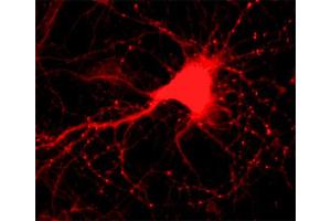Indirect immunostaining of hippocampus neurons (dilution 1 : 500). (Alpha, beta Synuclein (AA 2-25), (N-Term) antibody)