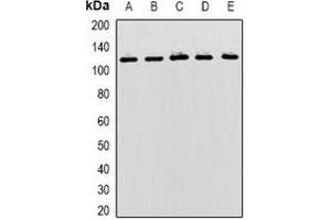 Western blot analysis of MBTPS1 expression in Hela (A), SKOV3 (B), mouse liver (C), mouse kidney (D), rat brain (E) whole cell lysates. (MBTPS1 antibody)