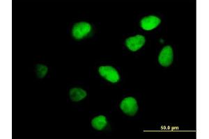 Immunofluorescence of purified MaxPab antibody to IKZF4 on HeLa cell.
