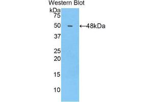 Western Blotting (WB) image for anti-Collagen, Type XIV, alpha 1 (COL14A1) (AA 1280-1461) antibody (ABIN1858447) (COL14A1 antibody  (AA 1280-1461))