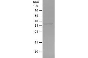 Western Blotting (WB) image for ATPase, Na+/K+ Transporting, beta 1 Polypeptide (ATP1B1) (AA 186-303) protein (His-IF2DI Tag) (ABIN7282154) (ATP1B1 Protein (AA 186-303) (His-IF2DI Tag))