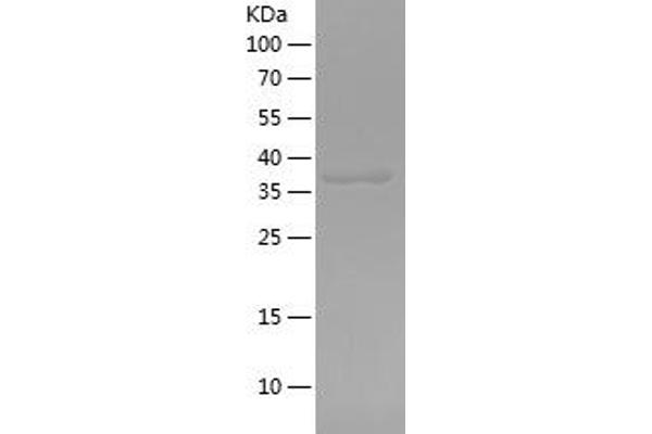 ATP1B1 Protein (AA 186-303) (His-IF2DI Tag)