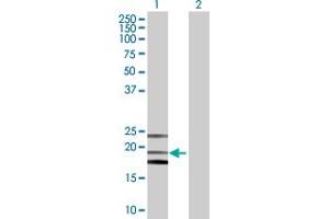 Western Blot analysis of PTGDS expression in transfected 293T cell line by PTGDS MaxPab polyclonal antibody. (PTGDS antibody  (AA 1-190))