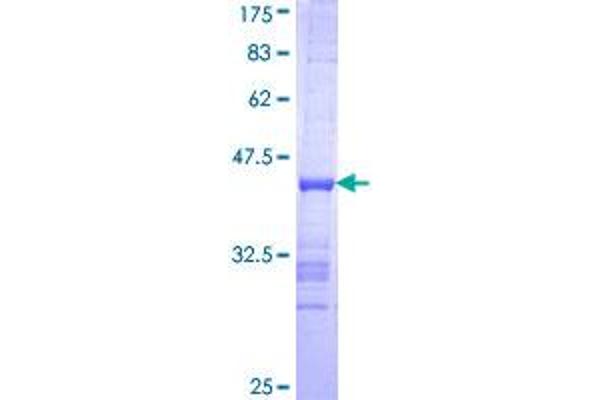 Exonuclease 1 Protein (EXO1) (AA 747-846) (GST tag)