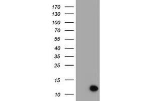 Image no. 1 for anti-Chromosome 17 Open Reading Frame 37 (C17orf37) antibody (ABIN1501775)