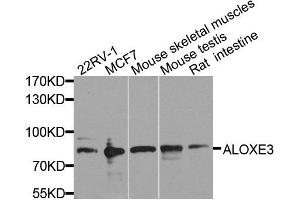 Western blot analysis of extracts of various cell lines, using ALOXE3 antibody. (ALOXE3 antibody  (AA 1-280))