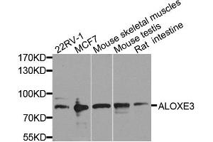 Western blot analysis of extracts of various cell lines, using ALOXE3 antibody.