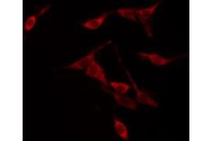 ABIN6267566 staining NIH-3T3 by IF/ICC. (14-3-3 zeta antibody  (pThr232))