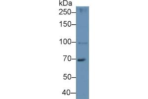 Detection of HPS4 in Mouse Liver lysate using Polyclonal Antibody to Hermansky Pudlak Syndrome Protein 4 (HPS4) (HPS4 antibody  (AA 20-214))