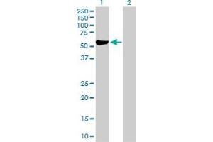 Western Blot analysis of ALDH3A1 expression in transfected 293T cell line by ALDH3A1 MaxPab polyclonal antibody. (ALDH3A1 antibody  (AA 1-453))