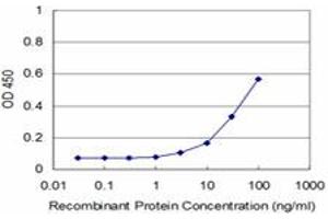 Detection limit for recombinant GST tagged FHIT is approximately 3ng/ml as a capture antibody. (FHIT antibody  (AA 31-130))