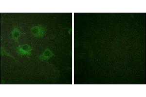 Immunofluorescence analysis of HuvEc cells, using Claudin 3 antibody.