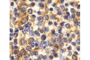 Immunohistochemistry of CCR3 in human spleen tissue with CCR3 antibody at 10 μg/ml. (CCR3 antibody  (C-Term))