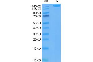 SARS-COV-2 Spike S Trimer (D614G) on Tris-Bis PAGE under reduced condition. (SARS-CoV-2 Spike Protein (D614G, Trimer) (His-Avi Tag))