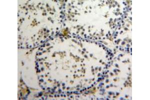 Used in DAB staining on fromalin fixed paraffin-embedded Testis tissue (AATF antibody  (AA 240-438))