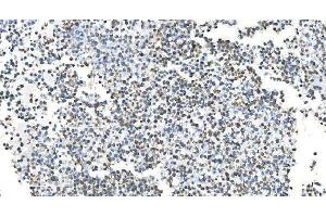 IHC analysis of DRP1/DNM1L using anti-DRP1/DNM1L antibody (ABIN7602180).