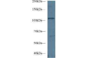 Western blot analysis of Human HeLa cell lysate, using Mouse EPHA1 Antibody (1 µg/ml) and HRP-conjugated Goat Anti-Rabbit antibody ( (EPHA1 antibody  (AA 716-960))