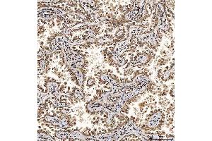 anti-Squamous Cell Carcinoma Antigen Recognized By T Cells (SART1) (AA 125-800) antibody