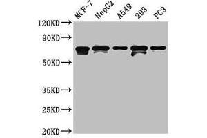 Western Blot Positive WB detected in: MCF-7 whole cell lysate, HepG2 whole cell lysate, A549 whole cell lysate, 293 whole cell lysate, PC-3 whole cell lysate All lanes: MAGED2 antibody at 4.