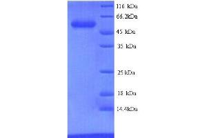 SDS-PAGE (SDS) image for GLPD (AA 1-501), (full length) protein (His tag) (ABIN5714032) (GLPD (AA 1-501), (full length) protein (His tag))