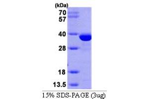 SDS-PAGE (SDS) image for Sulfotransferase Family 1E Member 1 (SULT1E1) (AA 1-294) protein (His tag) (ABIN666751) (SULT1E1 Protein (AA 1-294) (His tag))
