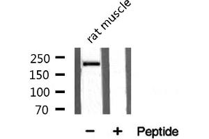 Western blot analysis on rat muscle tissue lysate using Sodium Channel-pan Antibody (Sodium Channel-Pan antibody)
