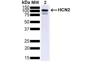 Western Blot analysis of Mouse Brain showing detection of ~95 kDa HCN2 protein using Mouse Anti-HCN2 Monoclonal Antibody, Clone S71 (ABIN361764).
