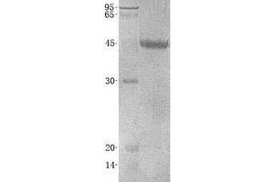 Validation with Western Blot (VSIG4 Protein (Transcript Variant 2) (His tag))