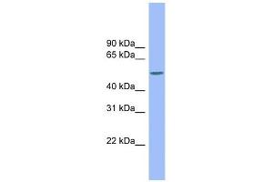 CSF1 antibody used at 1 ug/ml to detect target protein.