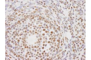 Immunohistochemistry (IHC) image for anti-Proline-, Glutamic Acid- and Leucine-Rich Protein 1 (PELP1) (AA 1000-1050) antibody (ABIN7448722) (PELP1 antibody  (AA 1000-1050))