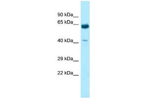 WB Suggested Anti-KRT9 Antibody Titration: 1. (KRT9 antibody  (C-Term))