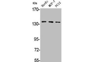 Western Blot analysis of HuvEc MCF7 PC12 cells using A Cyclase V/VI Polyclonal Antibody (ADCY6 antibody  (C-Term))