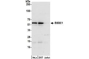 anti-BSD Domain Containing 1 (BSDC1) (AA 380-430) antibody