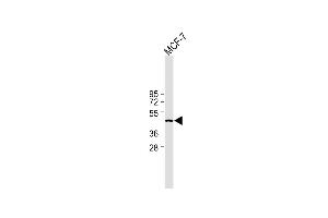 All lanes : Anti-IDH1 Antibody (Center) at 1:2000 dilution Lane 1: MCF-7 whole cell lysate Lysates/proteins at 20 μg per lane. (IDH1 antibody  (AA 116-143))