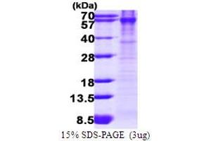 SDS-PAGE (SDS) image for B Lymphoid Tyrosine Kinase (BLK) (AA 1-505) protein (His tag) (ABIN667955)