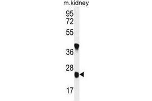 U119B Antibody (C-term) western blot analysis in mouse kidney tissue lysates (35 µg/lane). (UNC119B antibody  (C-Term))