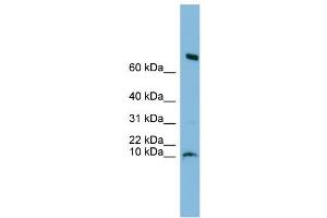 WB Suggested Anti-C1orf122 Antibody Titration: 0. (C1orf122 antibody  (N-Term))