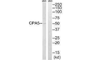 Western blot analysis of extracts from 293 cells, using CPA5 antibody. (CPA5 antibody)