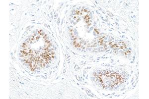 Immunohistochemistry (IHC) image for anti-Estrogen Receptor 1 (ESR1) antibody (ABIN7455134) (Estrogen Receptor alpha antibody)