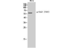 Western Blotting (WB) image for anti-Checkpoint Kinase 2 (CHEK2) (pThr387) antibody (ABIN3179638) (CHEK2 antibody  (pThr387))